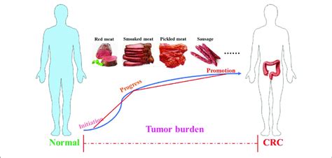 The Process Of Colorectal Cancer The Development Of Cancer Includes