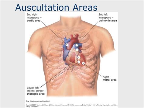 Ppt Heart Sounds And Murmurs Powerpoint Presentation Free Download