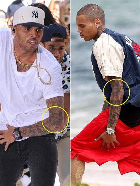 Chris Brown’s Tattoo Removed — He Erases Karrueche Tran From His Arm