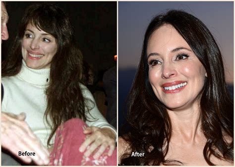 Madeleine Stowe Plastic Surgery Before And After Nose Job