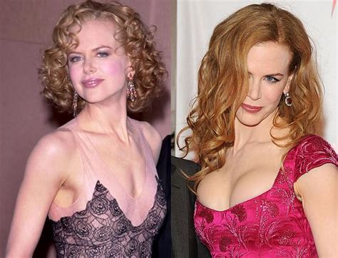 top 10 best breast implants of celebrities best boob