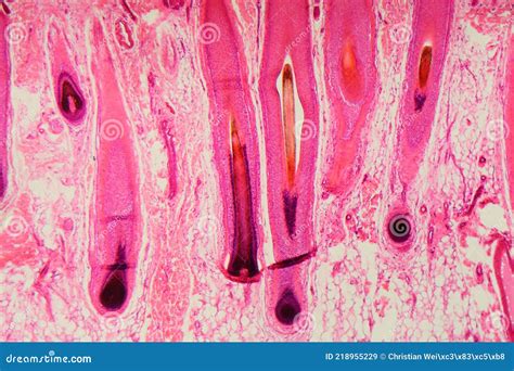 human hair follicle  skin   microscope stock image image  skin follicle