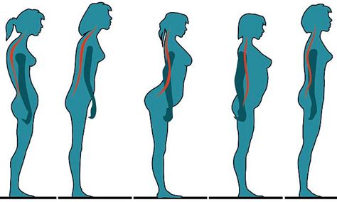 The British Chiropractic Association Says Posture Determines Whether