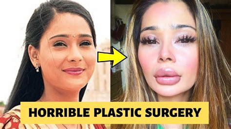 top  bollywood  tv actress plastic surgery
