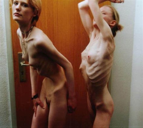 anorexic porn thread nws page 19 yellow bullet forums
