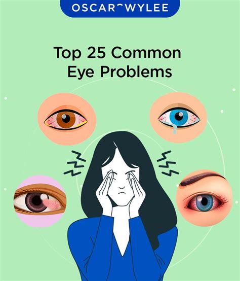 top  common eye problems