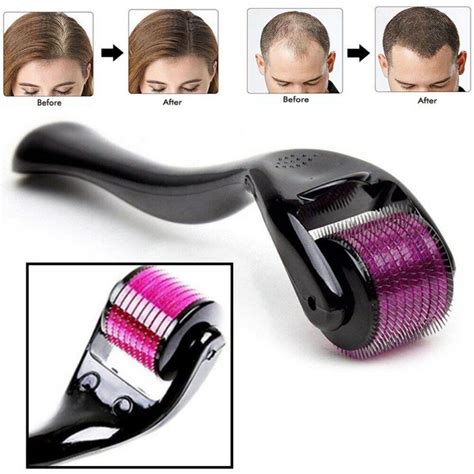 dermo roller  hair mm saamionlinecom spend  smile