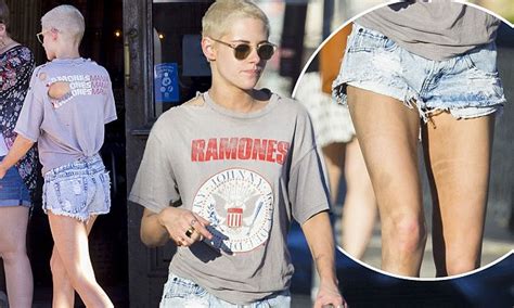 Kristen Stewart Steps Out With Mystery Marks On Her Legs Daily Mail