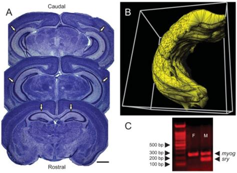 Three Dimensional Reconstruction Of The Hippocampal Com Open I