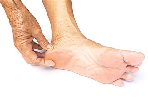 feet   natural   aging