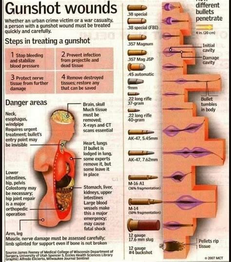 diagram    bullets       treat  bullet