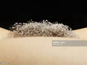 Excessive pubic hairy female