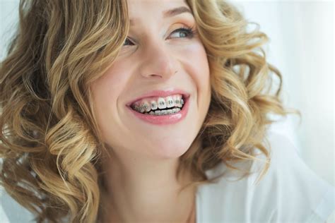 what are the benefits of braces beyond straight teeth team demas