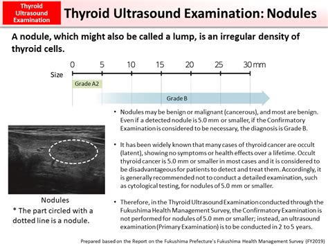 thyroid ultrasound examination nodules moe