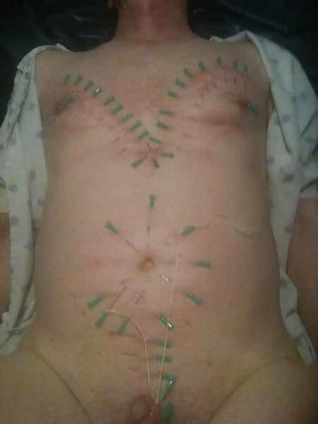 bdsm male slave nipple torture 15 pics xhamster