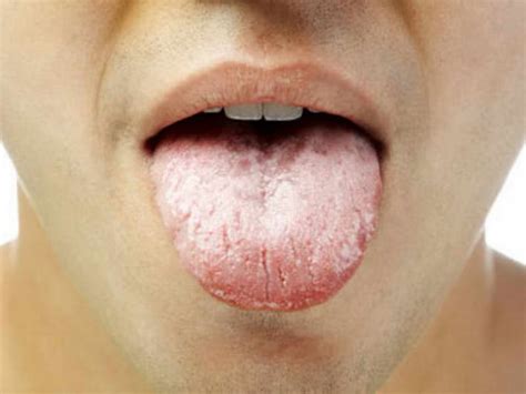 tongue tells    health