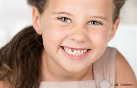 congenitally missing teeth       treat  oral