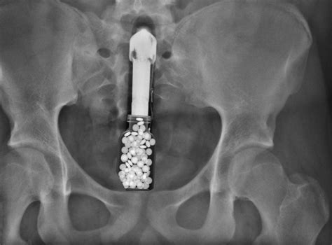 x ray of man inside woman