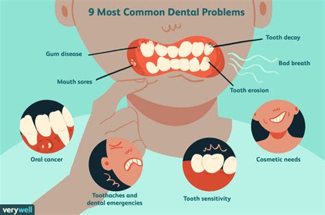 the 9 most common dental problems