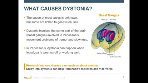dystonia in parkinson s disease captions quotes