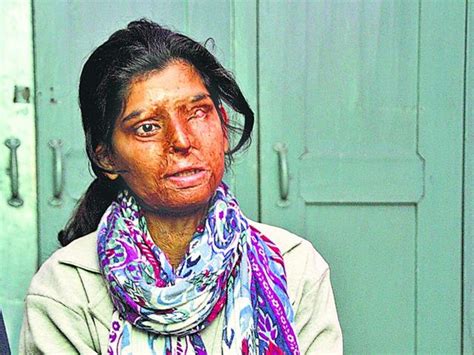 acid attack cases judgment      months ritu saini hindustan times