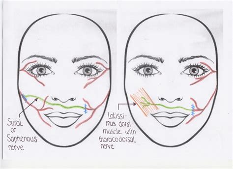 poding av ansiktsnerven