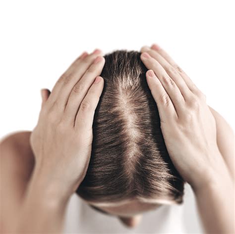 hair loss causes treatment and prevention aromase