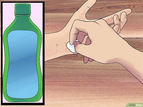 treat  cat bite  steps  pictures wikihow