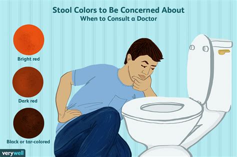 stool color  whats normal  whats