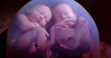 twin babies caught  mri scan fighting   mothers womb