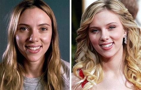 can you post some pictures of celebrities before and after
