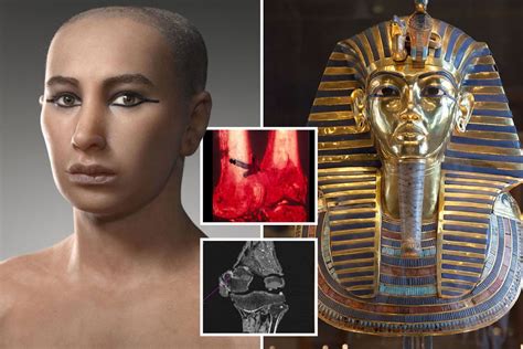 mystery  tutankhamuns death solved  academic claims infection  leg fracture killed