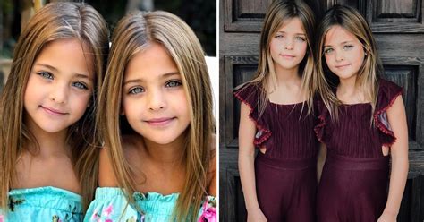 twins from california dubbed the most beautiful twins ever born and