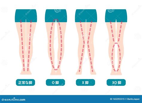 Diferencia De Tipos De ángulos De Piernas Y De Rodillas Ilustración