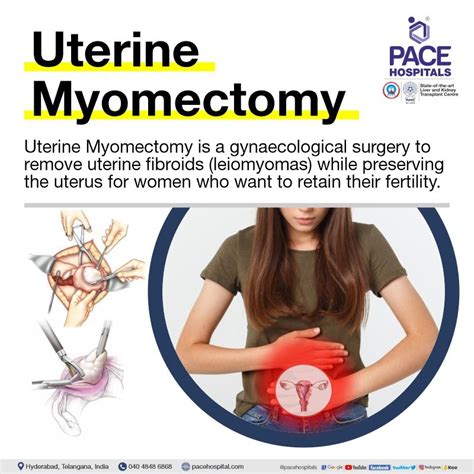Myomectomy Surgery In Hyderabad Indications Side Effects And Benefits