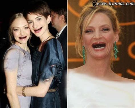 عکس های خنده دار از زنان زیبای هالیوود بدون دندان
