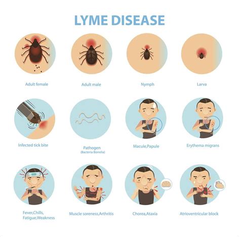 Lyme Disease Prevention And Resources Upmc Central Pa