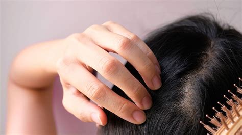 hair loss  women  treatments  females