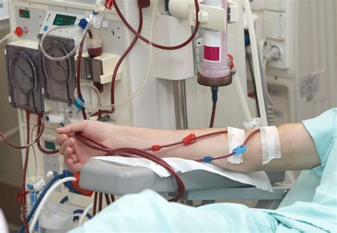 dialysis dialysis treatment britannica