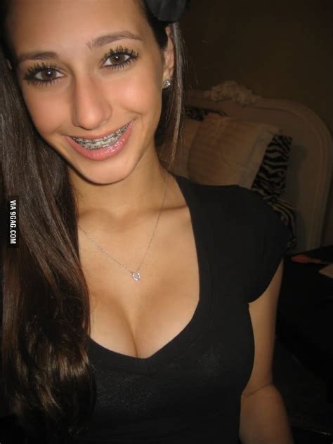 how do you guys feel about braces 9gag