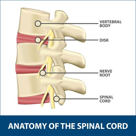 lumbar epidural steroid injection florida orthopaedic institute