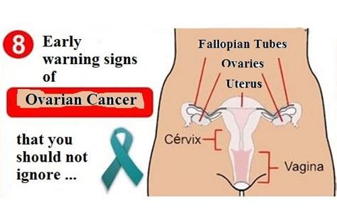 8 Early Signs Of Ovarian Cancer You Should Not Ignore