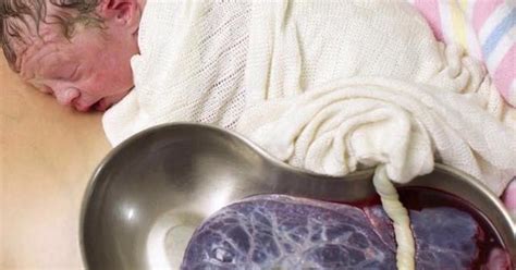 the incredible photo of delayed cord clamping after birth netmums
