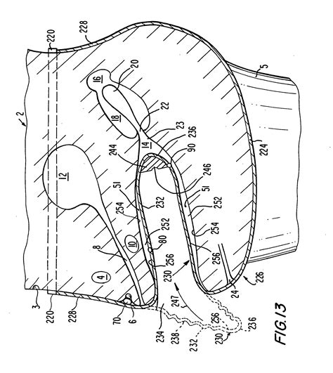 patent us20060231104 female barrier contraceptive with vacuum