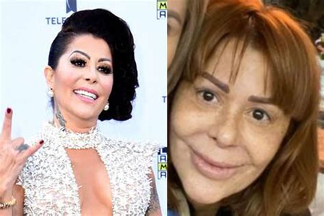 alejandra guzman asi ha sido la transformacion de su rostro fotos