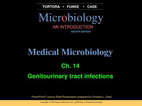 Ppt Ch 14 Genitourinary Tract Infections Powerpoint Presentation