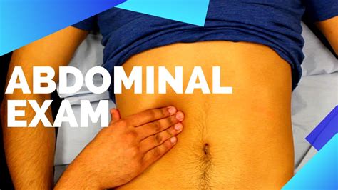 Abdominal Examination Osce Exam Demonstration Youtube