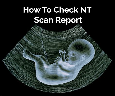 month nt scan report explained valuable insights  read results