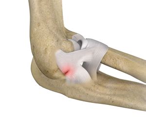 elbow ligament injuries orthoutah orthopaedic surgeons brigham city