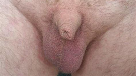 soft and small uncut cocks 301 pics xhamster